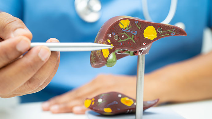 圖片 【脂肪肝 vs 酒精性肝病】成因、檢查方法及改善飲食全攻略