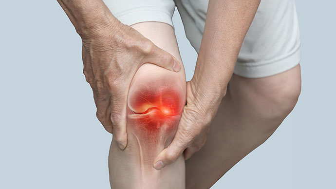 圖片 類風濕關節炎是什麼？高危族群｜檢測方法｜生活管理建議