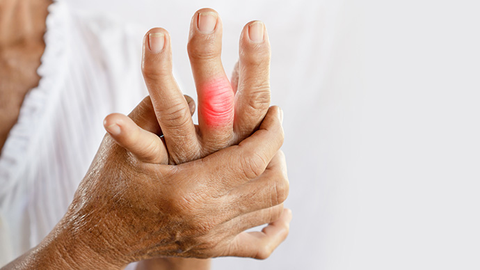 圖片 痛風是富貴病？高尿酸引發關節痛| 檢測| 飲食管理與預防攻略