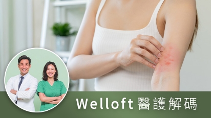 圖片 【醫護解碼】過敏測試全攻略：IgE、皮膚點刺、斑貼測試怎樣選？