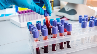 圖片 【白血球正常值】WBC偏高偏低成因全解析 | 檢查及改善貼士