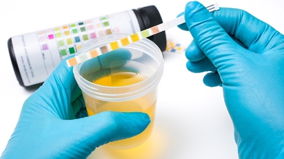 圖片 蛋白尿是腎病糖尿病先兆？深度解析成因、症狀及科學改善方法