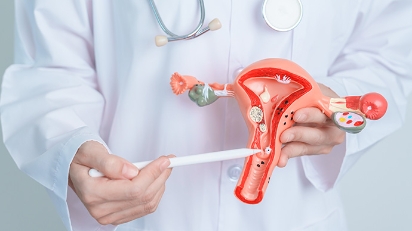 Picture of Ovarian Cancer Screening HK | CA125 Index & Pelvic Ultrasound Guide