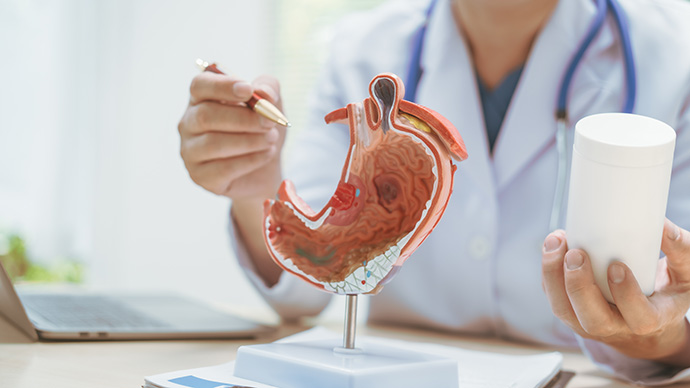 圖片 胃結石是什麼？胃石原因、症狀及檢查方法| 原來食菜都可能形成胃石