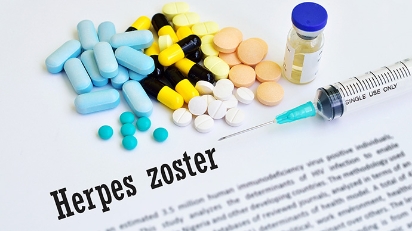 Picture of How Serious Is Herpes Zoster Ophthalmicus? Eye Shingles Symptoms, Causes, Contagion Risks, and Prevention Methods