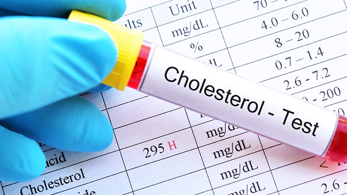 Comprehensive Cardiovascular Health Check in Hong Kong | Premium Heart ...